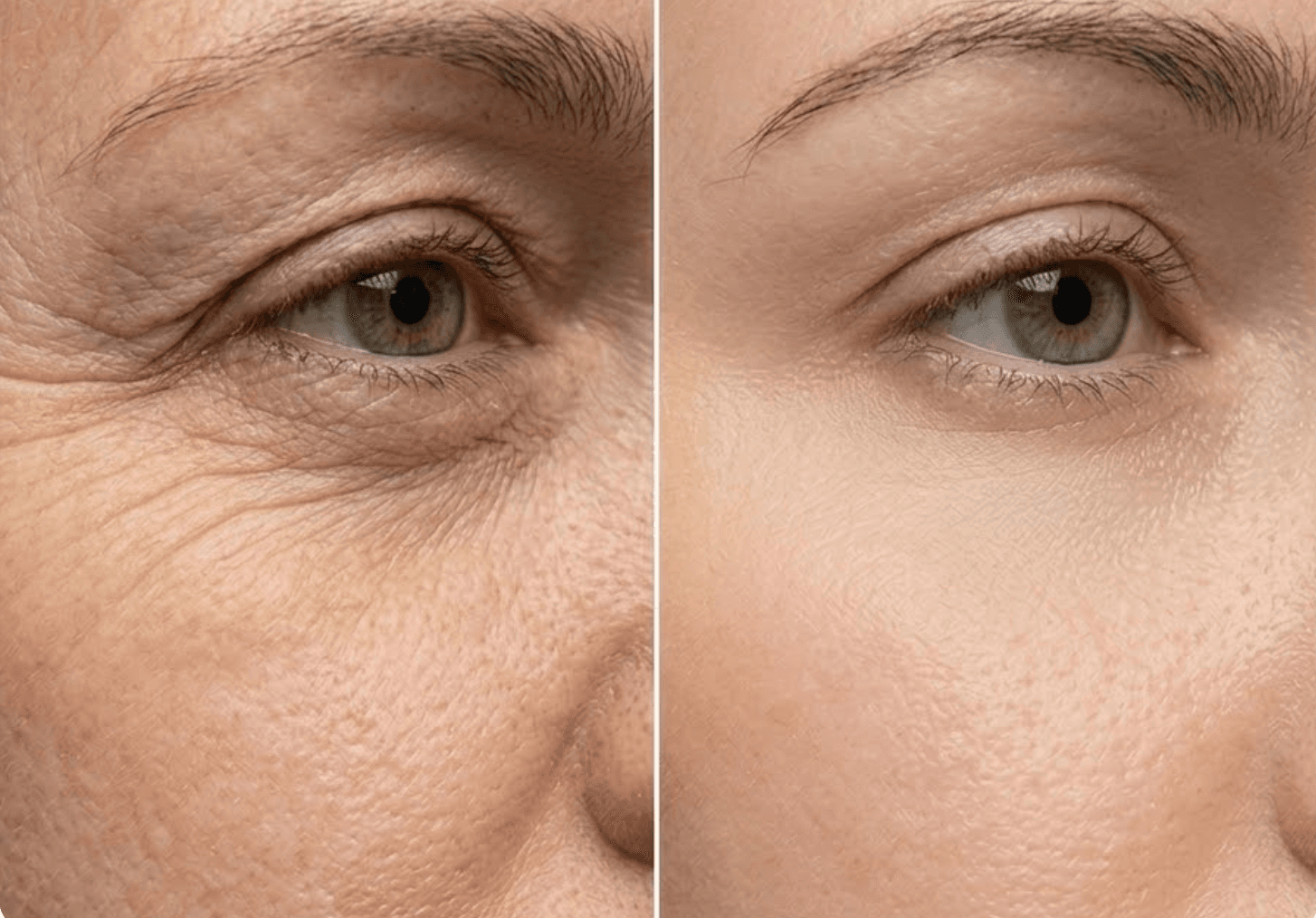 Before and after transformation 2