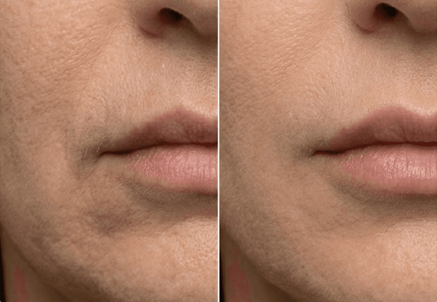 Before and after transformation 3