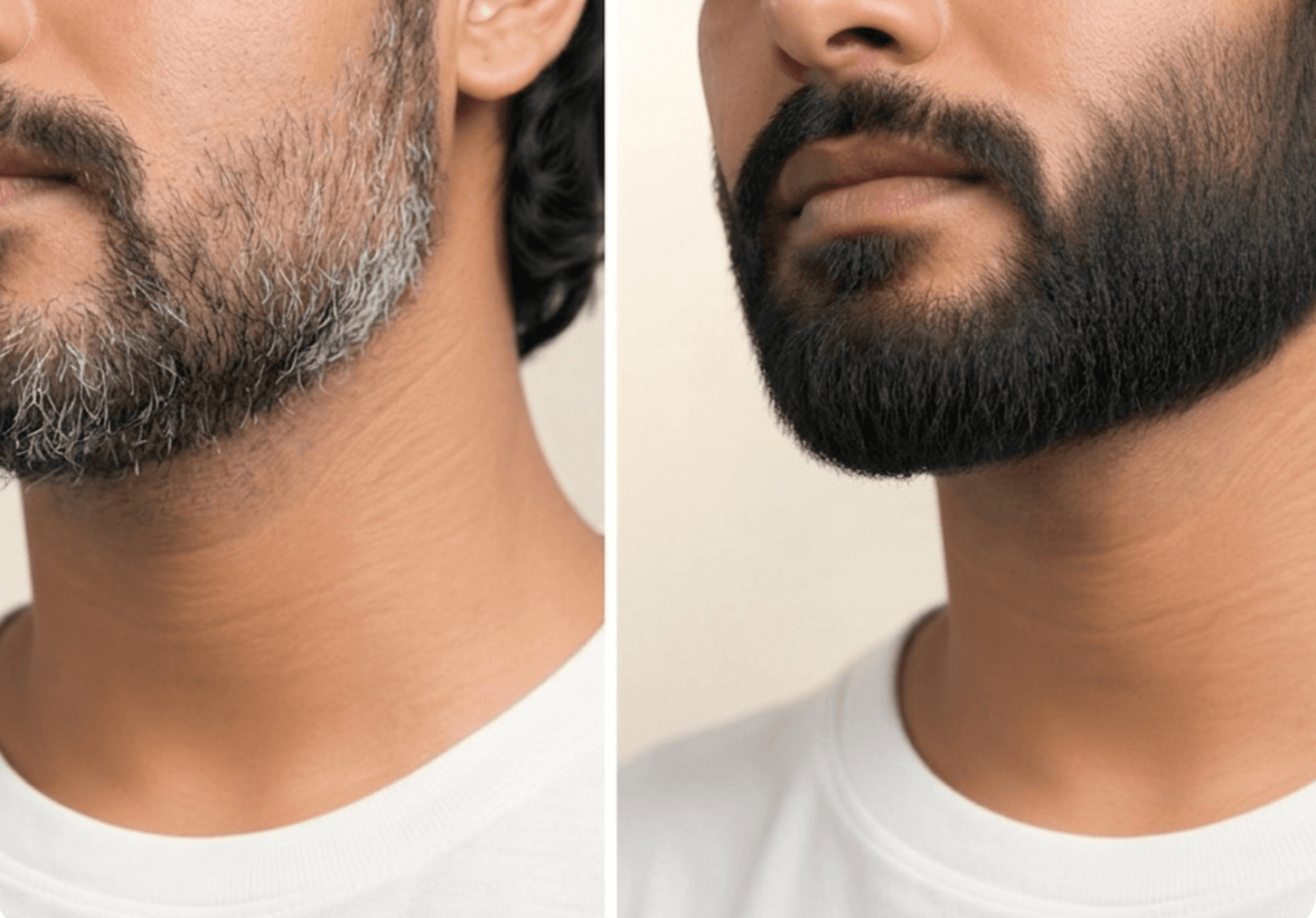 Before and after transformation 4