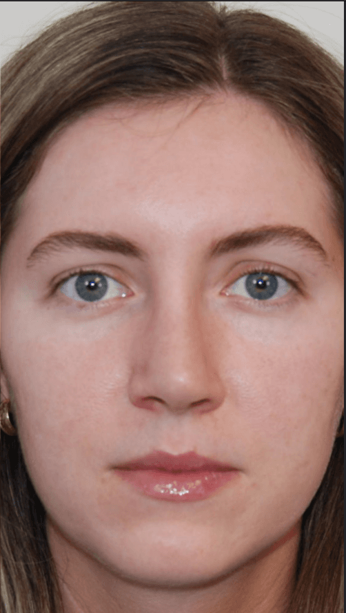 Treatment after outcome