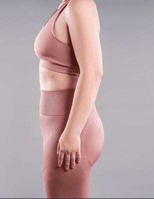 Treatment after outcome