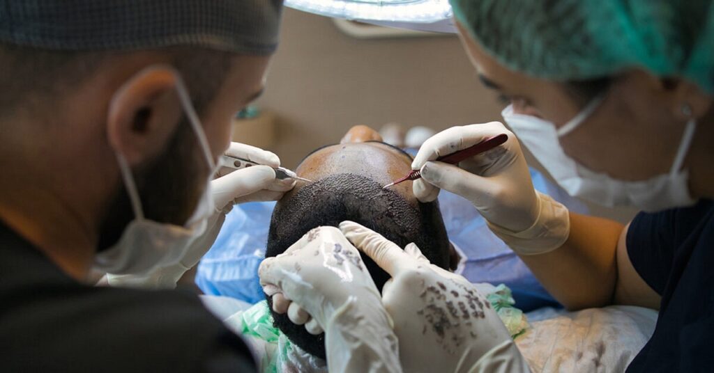 Hair Transplant with Dr. Vijay Kumar at AWISH Clinic