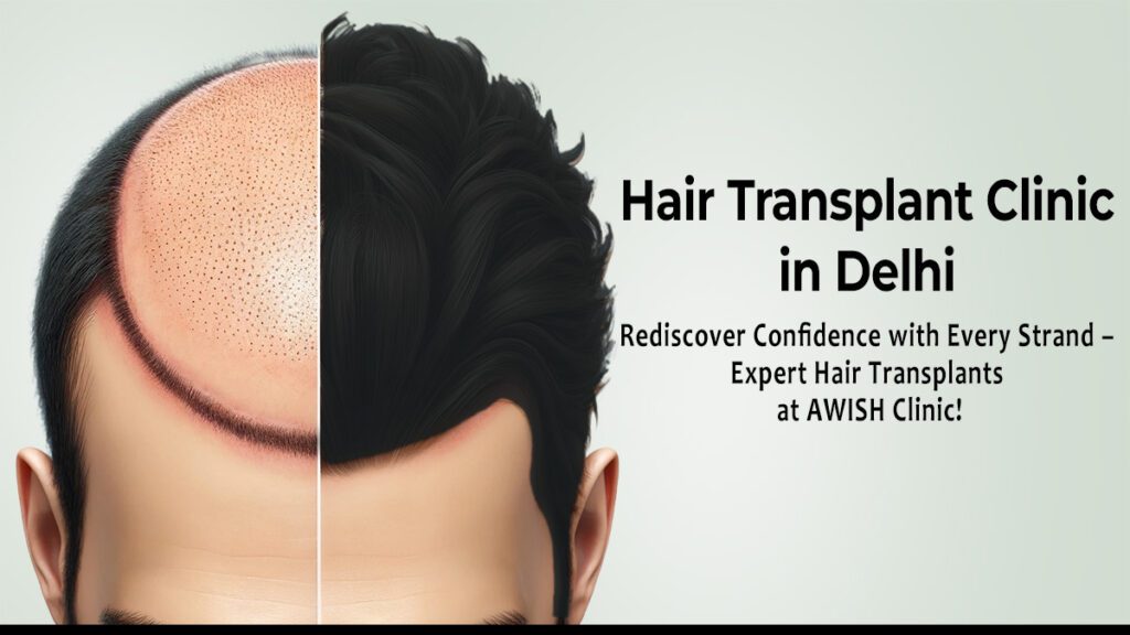 A patient undergoing a hair restoration hair transplant procedure at AWISH Clinic