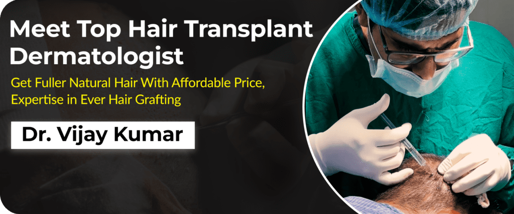 Top Hair Transplant Treatment | Best Dermatologist Hair & Skin Specialist In Delhi NCR at AWISH Clinic