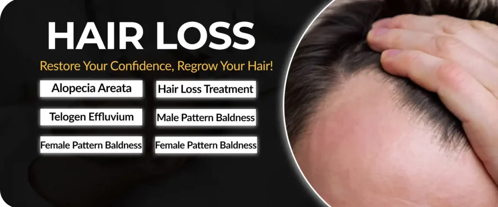 Hair Loss Treatment