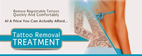 get tattoo removal treatment at best price in delhi