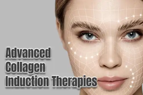 Advanced Collagen Induction Therapies