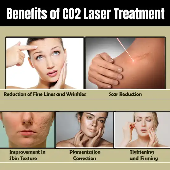 Benefits of CO2 Laser Treatment at AWISH Clinic​