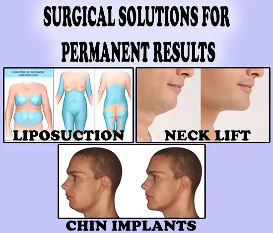 Surgical Solutions for Permanent Results