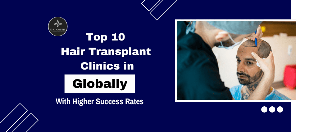 Top 10 Hair Transplant Clinics Globally