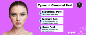 Types of Chemical peels