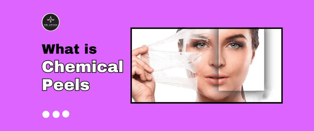 When to Visit to Dermatologist for winter Chemical Peel Treatment